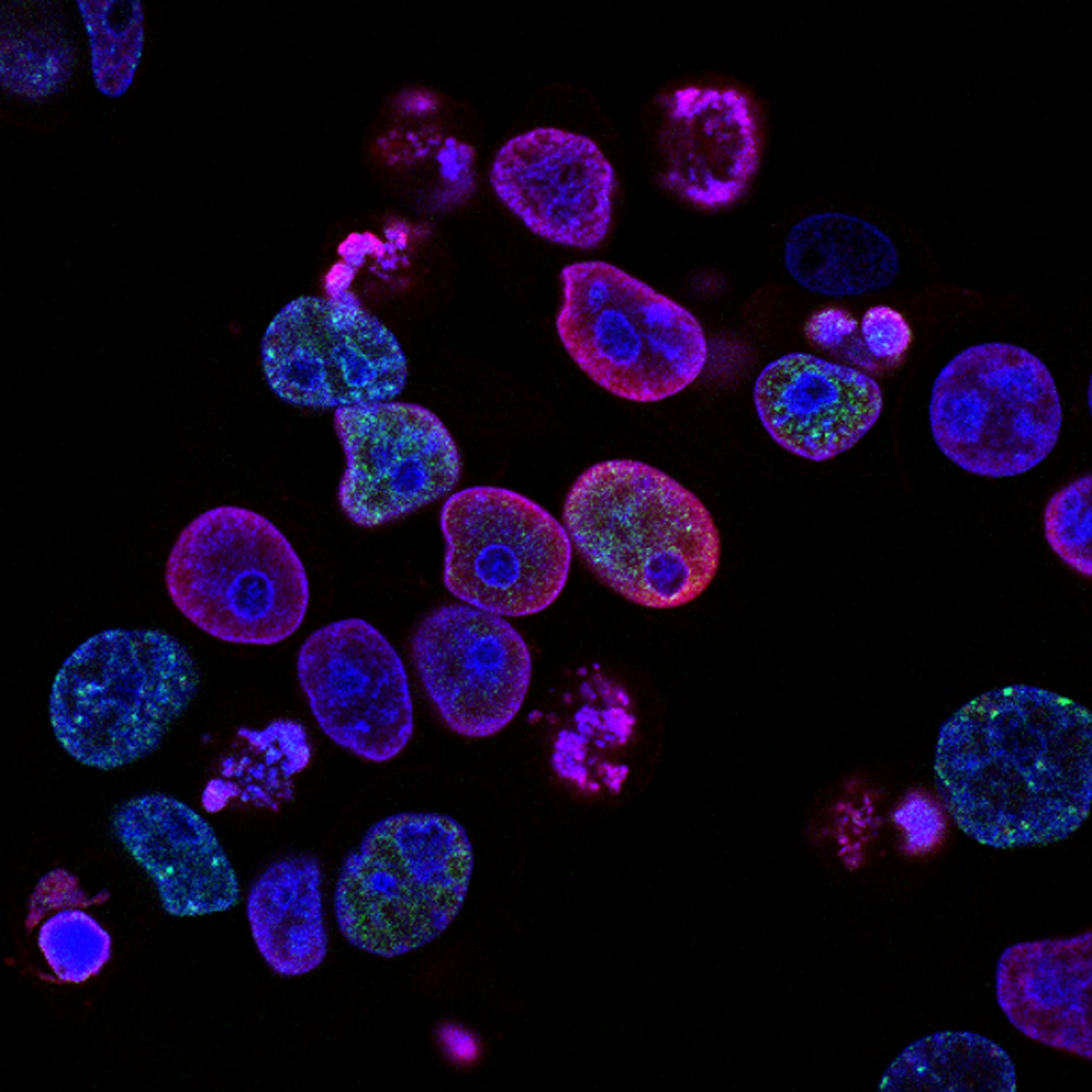 Fluorescence microscopy image of stained cells